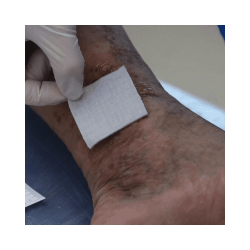 AQUACEL Ag Dressing, 5 × 5 cm