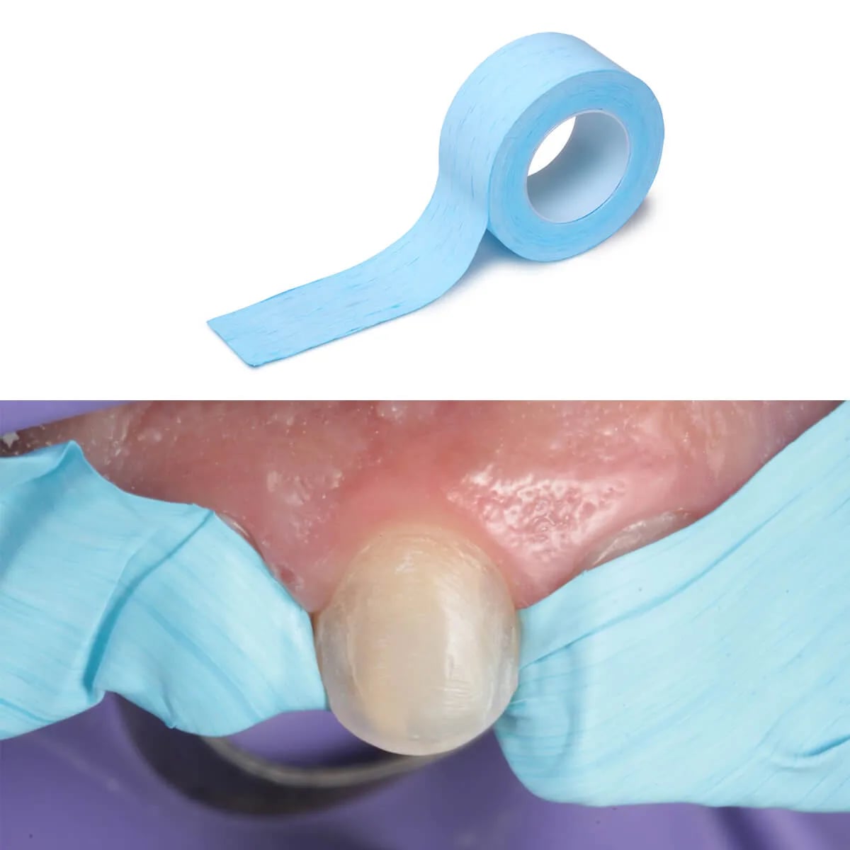 IsoTape, Teeth Isolation Tape, 5µm